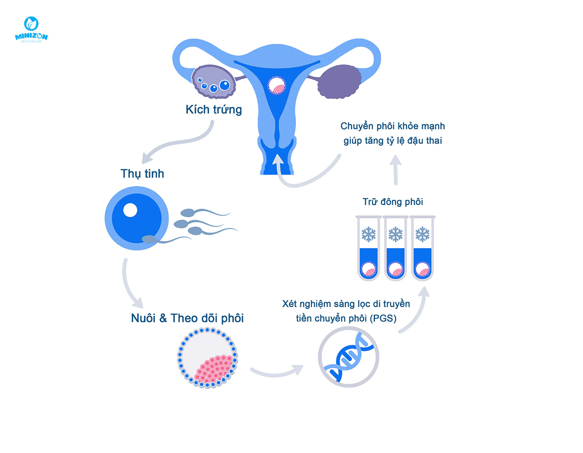 Thụ tinh ống nghiệm IVF là gì?